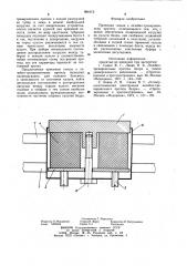 Приемная гильза к лечебно-тренировочному протезу (патент 984473)