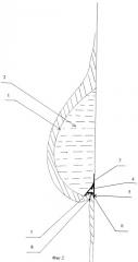 Имплантат молочной железы (патент 2340308)