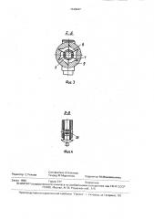 Протез бедра (патент 1648447)