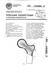 Устройство для остеосинтеза шейки бедра (патент 1181652)