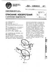 Устройство для крепления съемных зубных протезов (патент 1393414)