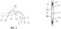Ортез коленного сустава (патент 2494705)