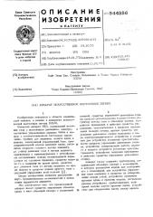 Аппарат искусственной вентиляции легких (патент 544356)