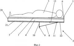 Устройство адаптации положения больного при движении секций ложа (патент 2575597)