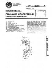 Устройство для лечения привычного вывиха в височнонижнечелюстном суставе (патент 1149957)