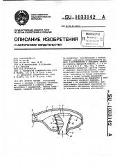 Протез сердца (патент 1033142)