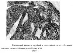 Способ лечения гнойно-воспалительных заболеваний околоносовых пазух (патент 2268048)