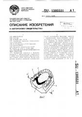 Способ изготовления бюгельных протезов (патент 1505531)