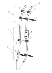 Динамический аппарат для исправления сколиотической деформации позвоночника и способ его применения (патент 2644750)