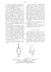 Эзофагоскопическая трубка (патент 1274678)