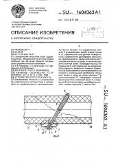 Устройство для остеосинтеза (патент 1604363)