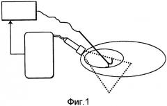 Основанная на анализе изображений обратная связь для регулирования мощности для формирования оптимального ультразвукового изображения радиочастотного удаления тканей (патент 2460489)