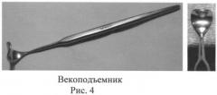 Способ овариогистерэктомии кошек по боковому доступу (патент 2396923)