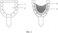 Способ лечения вывиха внутрисуставного диска височно-нижнечелюстного сустава (патент 2527841)