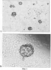 Способ клонирования in vitro регионарных стволовых клеток поджелудочной железы (патент 2308281)