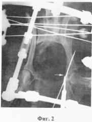 Способ лечения повреждений тазобедренного сустава у мелких домашних животных (патент 2371144)