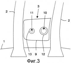Облегченная междулопаточная площадка для опорного диска лопаток вентилятора турбореактивного двигателя и опорный диск лопаток (патент 2343292)