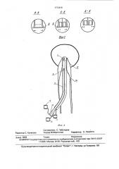 Устройство для диагностики сужений терминального отдела холедоха (патент 1773414)