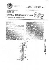 Протез бедра (патент 1801416)