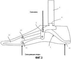 Искусственная стопа (патент 2352297)