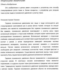 Устройство для лечения путем подкожной подачи пониженного давления с использованием разделения с помощью воздушного баллона (патент 2401652)