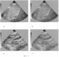 Способ обработки и отображения эхо-сигналов для дифференциации биологических тканей в ультразвуковых диагностических сканерах (патент 2253370)