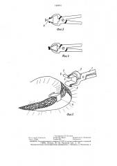 Инструмент для наложения кровоостанавливающего зажима (патент 1424811)