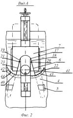 Способ лечения коксартроза тазобедренных суставов и устройство для его осуществления (патент 2397747)