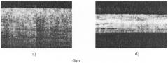 Устройство получения контрастных окт изображений (патент 2314034)
