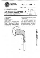 Эндопротез сустава (патент 1127584)