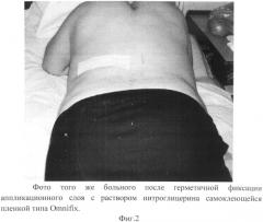Способ стимуляции секреции инсулина (патент 2550798)