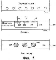 Нейростимулятор и способ стимуляции нервной ткани (патент 2465930)