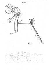 Фиксатор для бедренной кости (патент 1326260)