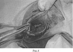 Способ оперативного доступа к нижней челюсти в эксперименте на кролике (патент 2550128)