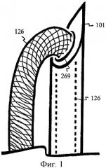 U-образный дисковый шунт и устройство доставки (патент 2438605)