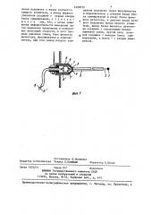 Устройство для измерения скоростных характеристик потока (патент 1420533)