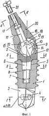 Зубной имплантат с поворотной опорой (патент 2362507)