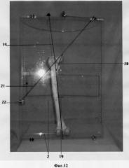 Устройство для антропометрических измерений длинных трубчатых костей (патент 2245101)
