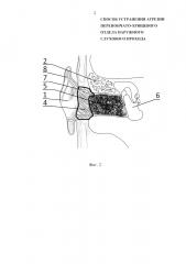 Способ устранения атрезии перепончато-хрящевого отдела наружного слухового прохода (патент 2621948)