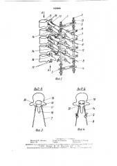 Устройство для вправления и фиксации позвонков (патент 1623636)