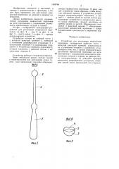 Устройство для рассечения межкостной перепонки (патент 1389766)