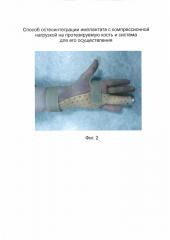 Способ остеоинтеграции имплантата с компрессионной нагрузкой на протезируемую кость и система для его осуществления (патент 2631631)