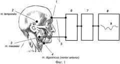 Способ регистрации моторной работы жевательной мускулатуры у человека (патент 2561332)