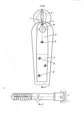 Устройство для остеосинтеза бедренной кости (патент 929086)