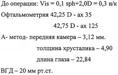 Способ определения показаний к выбору метода анестезии при микрохирургических операциях по поводу катаракты при наличии сопутствующей патологии сетчатки макулярной области (патент 2357706)