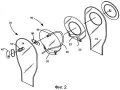Стомный мешок (патент 2506934)