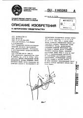 Способ определения формы посадочного кольца приемных гильз протезов бедра (патент 1165383)