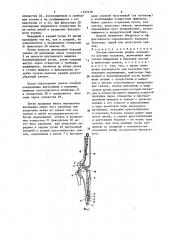 Костно-связочная модель коленного сустава человека (патент 1529278)