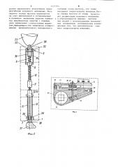 Протез бедра (патент 1237204)