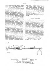 Устройство для лечения переломов кости (патент 921552)